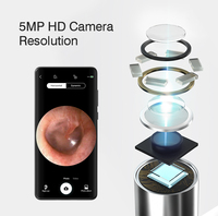 Precio de Liquidación: Set Limpiador de Oídos con Cámara Digital Inalámbrica HD 6LED 5MP 3.5mm para Eliminar Cera