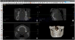 Kullanılmış Vatech PaX-i3D 3D Tanı Panoramik Diş Röntgeni 3'ü 1 Arada Pano CBCT Ceph Dijital Opg Cihazı - Product Image 5