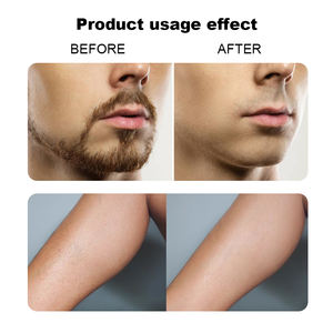 Aceite de Afeitar Hidratante Oalen con Aroma a Vainilla, Libre de Crueldad Animal, con Manteca de Karité para el Cuidado Corporal Femenino, Calmante y Protector de Cortes, Impresión Láser - Product Image 6