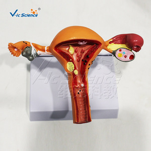 Modelo patológico uterino femenino, modelo anatómico de órgano reproductor ginecológico, molde para enseñanza y formación médica. - Product Image 2