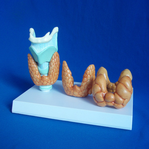 Modelo Anatómico de Tiroides Humano para Enfermedades de la Tiroides, Modelo Patológico para Ciencias Médicas - Product Image 1