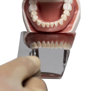 Quatre pièces professionnelles en acier inoxydable dentaire pour la photographie intra-orale, réflecteur orthodontique - Product Image 1