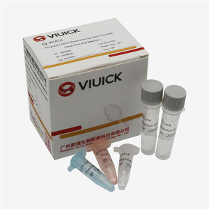 Kit de test PCR CCHF pour <span class=keywords><strong>la</strong></span> fièvre hémorragique du Congo de Crimée, diagnostic PCR en temps réel, IVD certifié ISO13485, modè<span class=keywords><strong>le</strong></span> NCEP-R-5131 1 - Product Image 1