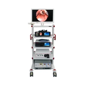 Medic Endoscopi Camera Gynaecologisch Onderzoek Machine Hysteroscopie Torens