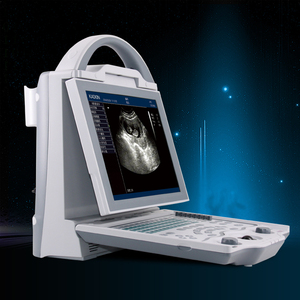 Échographe vétérinaire portable Sonoscape Dawei USMILEPET, appareil d'échographie portable pour animaux - Product Image 5