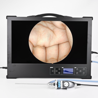 Sistema de endoscopia de pantalla de luz de cámara todo en uno para cirugía mínimamente invasiva Imágenes en tiempo real con diseño portátil ergonómico