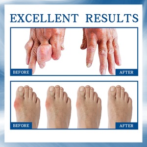 Soulagement des douleurs articulaires, roulement des boules pour réduire l'inflammation et l'inconfort, favorisant <span class=keywords><strong>la</strong></span> circulation sanguine - Product Image 5
