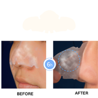 Patchs Nasaux Hydrocolloïdes Professionnels Invisibles de Qualité Supérieure pour Couvrir les Imperfections du Nez et Traitement de l'Acné du Visage – Grande Taille