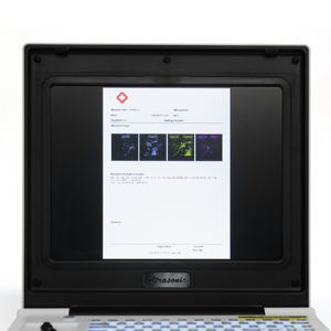 Ultrasone echografie-apparaat voor huisdieren, diagnostische ecograaf, digitale hart-echografie, zwart-wit PW-ultrasone scanner - Product Image 5