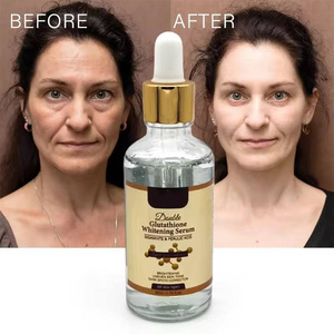 Crema Corporal Blanqueadora con Ácido Kójico Herbal Orgánico, Glicerina, Colágeno y Ácido Hialurónico, Antienvejecimiento, Corrector de Manchas Oscuras - Product Image 2