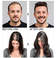Weilianfu Perawatan Rambut Organik Khusus untuk Menghaluskan dan Memperbaiki, Anti Rontok, Penumbuh Kembali, Elixir Kulit Kepala, Serum Minyak Penumbuh Rambut 100ml