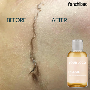 <span class=keywords><strong>Aceite</strong></span> Dermaplane Personalizado para Piel Sensible - <span class=keywords><strong>Aceite</strong></span> Hidratante para Depilación Facial para Mujeres - Seguro para Piel Propensa al Acné - No Comedogénico - Product Image 5