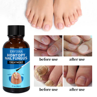 Huile de traitement des ongles fongique des pieds pour la réparation des pieds, sérum pour les ongles des orteils abîmés