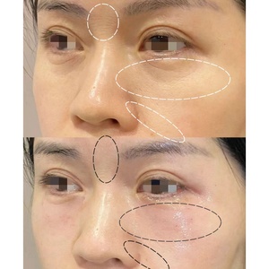 Suero Exfoliante con Triple Enzima, Papain, Bromelina y Superóxido Dismutasa, Terapia Enzimática Bio Proteasa para Lifting Facial - Product Image 4