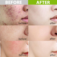 100% Extrait naturel pour Hydro Jelly Powder Mask Roya Masque blanchissant instantané sucré pour le visage et le corps