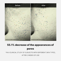 Crème de Jour Zéro Pores, Contrôle du Sébum, Resserre les Pores, Hydratant pour Peaux Grasses et Pores Dilatés, Usage Quotidien
