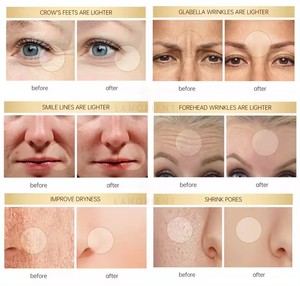 Private Label LANORIENT naturale organico vitamina C idratante Anti-invecchiamento sbiancante coreano cura della pelle crema al retinolo - Product Image 5