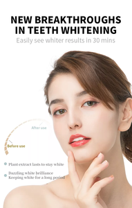 Bandes blanchissantes pour les dents noires, 14 traitements, charbon actif, élimination des taches, <span class=keywords><strong>bande</strong></span> <span class=keywords><strong>dentaire</strong></span> antidérapante avec étiquette privée personnalisée - Product Image 6