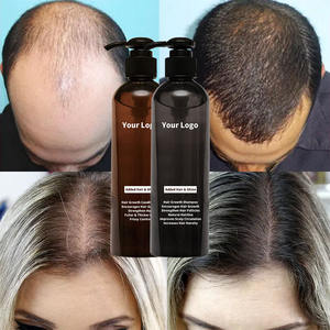 <span class=keywords><strong>Shampooing</strong></span> et revitalisant pour cheveux bouclés, <span class=keywords><strong>anti</strong></span>-<span class=keywords><strong>chute</strong></span>, hydratant, biotine organique, marque privée, meilleure qualité - Product Image 3