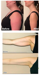 <span class=keywords><strong>Huile</strong></span> de gingembre naturelle pure pour massage, aromathérapie et diffuseur, drainage abdominal, réchauffement, soulagement des muscles endoloris et fatigués, avec compte-gouttes - Product Image 5