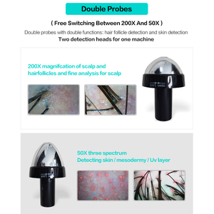 Lufenbeauty Intelligent Detection Beauty Salon Use Handheld Hair Scalp Analyzer Machine Hair Analyser - Product Image 5