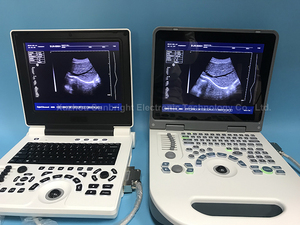 Mesin <span class=keywords><strong>Ultrasound</strong></span> portabel Laptop <span class=keywords><strong>Ultrasound</strong></span> B mesin <span class=keywords><strong>Ultrasound</strong></span> SUN -806H MSK Harga pemindai diagnostik - Product Image 5