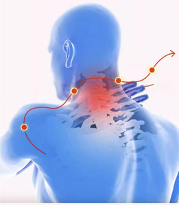 Rachide cervicale tratto gravità rilassamento muscolare trazione collo e spalla <span class=keywords><strong>cuscino</strong></span> massaggio alleviare il dolore correzione della colonna vertebrale - Product Image 3