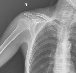 固定ダブルカラムNEW20kw <span class=keywords><strong>200ma</strong></span>高周波<span class=keywords><strong>X</strong></span>線装置 - Product Image 5