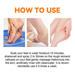 Spray <span class=keywords><strong>masque</strong></span> exfoliant pour les pieds, les talons et les coudes, parfum citron perlé, qualité supérieure, exclusivité transfrontalière RSNY, 100 ml - Product Image 4