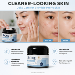 <span class=keywords><strong>Crema</strong></span> <span class=keywords><strong>Viso</strong></span> Private Label per <span class=keywords><strong>Pelle</strong></span> <span class=keywords><strong>Grassa</strong></span>, Trattamento Rapido di 1 Settimana per la Prevenzione <span class=keywords><strong>e</strong></span> Riparazione delle Cicatrici, Controllo dell'Acne <span class=keywords><strong>e</strong></span> delle Imperfezioni - Product Image 5