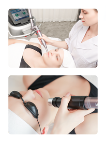 Picocare Lutron <span class=keywords><strong>Laser</strong></span> Picoseconde pour l'élimination des tatouages, Machine de suppression de tatouages, <span class=keywords><strong>Laser</strong></span> Picosegundos, Picolaser - Product Image 4