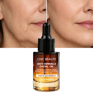 CHIC BEAUTE DNA โซเดียมและสารสกัดจากเซลล์เม็ดเลือดขาว เปปไทด์ เซรั่มบำรุงผิวหน้าลดเลือนริ้วรอย น้ำมันบำรุงผิวหน้าช่วยเติมความชุ่มชื้นและปลอบประโลมผิว น้ำมันบำรุงผิวหน้าลดเลือนริ้วรอย - Product Image 1