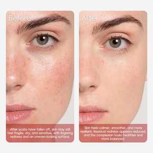 Suero Reparador de Piel de Marca Privada, Esencia de Ceramida para la Recuperación de la Barrera Cutánea, Suero Facial Hidratante para Piel Post-Operativa - Product Image 3