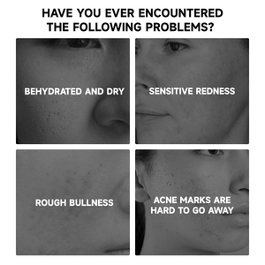 เซรั่มน้ำมันใบหน้าโรสฮิปครีมบำรุงผิวต่อต้านริ้วรอยและกำจัดรอยแผลเป็นจากธรรมชาติ Jmfree OEM - Product Image 4