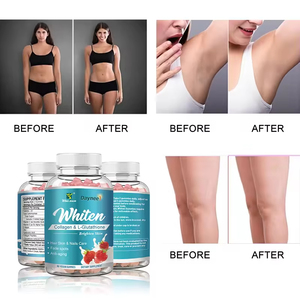 Factory Owned Brand Customized <b>Collagen</b> & G-lutathione Gummies for Smooth Skin Gummies Supplement - Product Image 4
