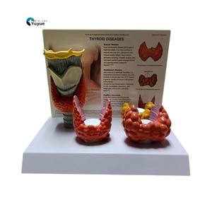Tıbbi % Model beyin insan tiroid hastalığı anatomi modeli, endokrinoloji eğitimi için gerçekçi tiroid patoloji simülatörü - Product Image 1