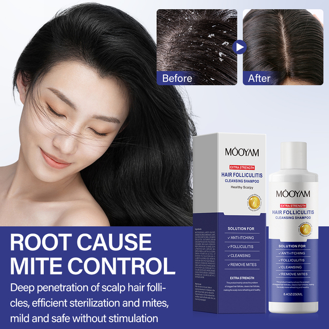 Tea Tree Oil Seborrheic Dermatitis Shampoo Antifungal Scalp Psoriasis Shampoo Salicylic Acid Folliculitis Shampoo Private Label