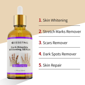 Vente en gros de soins corporels naturels à base de plantes réduisent les imperfections et la pigmentation, adoucissent les articulations foncées, le coude et le genou, sérum de blanchiment rapide - Product Image 3