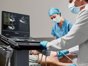 SonoScape Ultrasone Probe Transducer, Convex, Micro-Convex, Rectaal, Lineair, Phased Array Origineel en Gloednieuw voor Veterinair gebruik - Product Image 3