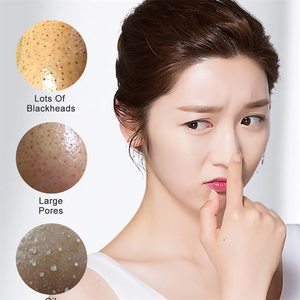Spongilla Spicule Peel Needling Peel Resurfacing Exfoliant Powder Spongilla Spicules Polvo Extracto de algas marinas de alta calidad 2024G - Product Image 5