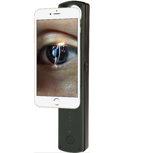 Nouvelle Lampe à Fente Numérique Ophthalmique Ultra-Portable à Main, Compatible Smartphone, Grossissement 6X - Prix - Product Image 1