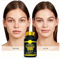 Capsules de Glutathion Liposomal 20000mg Éclaircissement de la Peau Anti-Acné Hyperpigmentation Collagène Élasticité Éclat 60 gélules