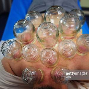 5 Größe Mix chinesische medizinische Schröpfen Hijama Tassen Glas Feuer Schröpfen Massage therapie Ventosa Sterilisator Feuer Vakuum Glas Schröpfen - Product Image 4