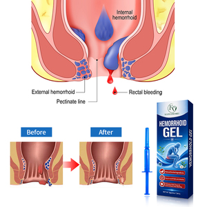 Gel Herbal <span class=keywords><strong>para</strong></span> el Cuidado de <span class=keywords><strong>Hemorroides</strong></span> 2026, Ungüento Humectante y Calmante Profundo, Fórmula de Medicina China - Product Image 6