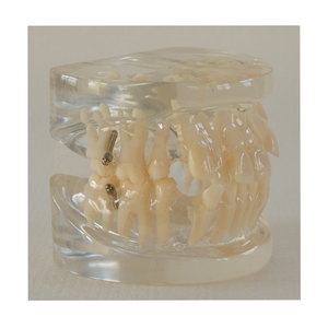 Modelo de estudio de dientes de ortodoncia dental 24 dientes - Product Image 4