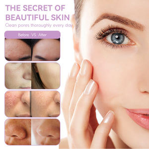 <span class=keywords><strong>Notime</strong></span>-equipo de belleza multifunción de iones, productos de belleza, cuidado de la piel, limpieza Facial portátil, dispositivo de belleza - Product Image 3