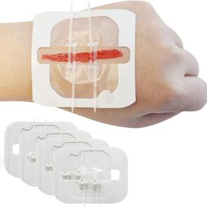 Dispositivos médicos desechables Cierre de piel no invasivo Yeso para heridas Cierre de heridas Cremallera - Product Image 2