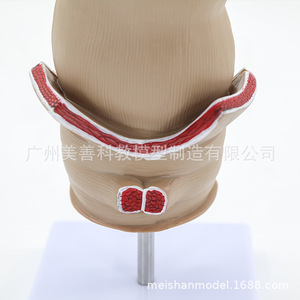 Modèle de hémorroïdes rectales et de lésions colorectales ; hémorroïdes rectales internes et externes et modèle anorectal ; pathologie rectale. - Product Image 5