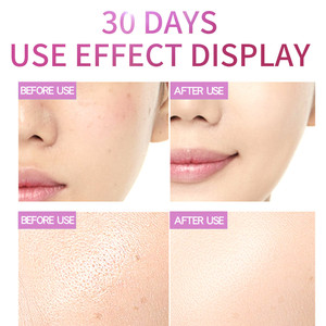 Tóner Facial blanqueador y reafirmante, extracto de rosa, pulverizador de vapor, <span class=keywords><strong>agua</strong></span> rosa, OEM/ODM - Product Image 4
