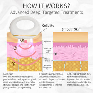 3 في 1 جهاز تنحيف الجسم بالحرارة ، وتنحيف الوجه والجسم ، وتشديد الجلد ، والضغط على الساق وفقدان الوزن ، جهاز التيار الصغير - Product Image 6